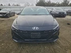 Driver Lower Control Arm Front Naturally Aspirated Fits 21-25 Elantra 3137795 Used. Price: $122.69.